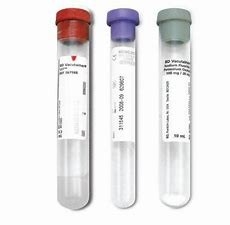 Sst-Laborrohr-Serologie-Serum-Gel-Sammlungs-Rohr für Blut-abgehobenen Betrag fournisseur